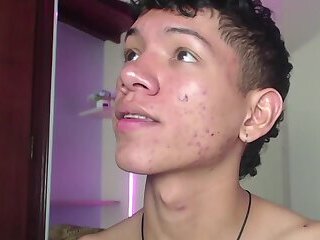 gorgeous teen cam boy with cute braces and acne